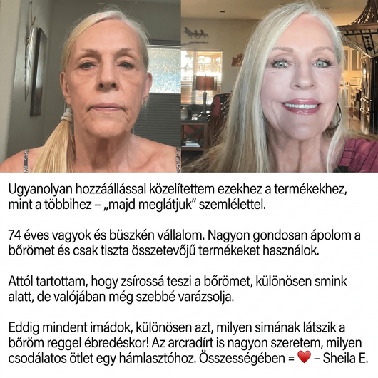 Derma - Teljes Bőrfiatalító Rendszer - 4db Balzsam