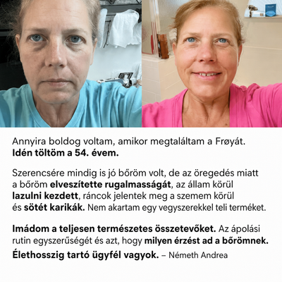 Derma - Teljes Bőrfiatalító Rendszer - 4db Balzsam